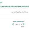 توريد TUBE FEEDING NASO